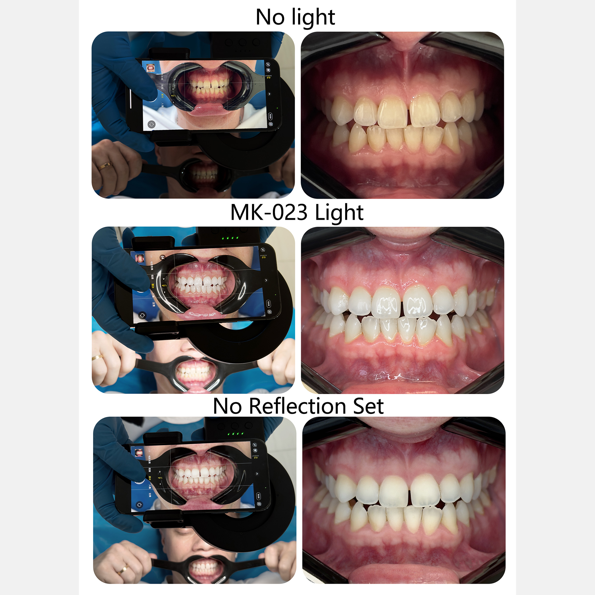 HERA MK-23 Intraoral Dental Ph - огляд і ціна Photography Dental