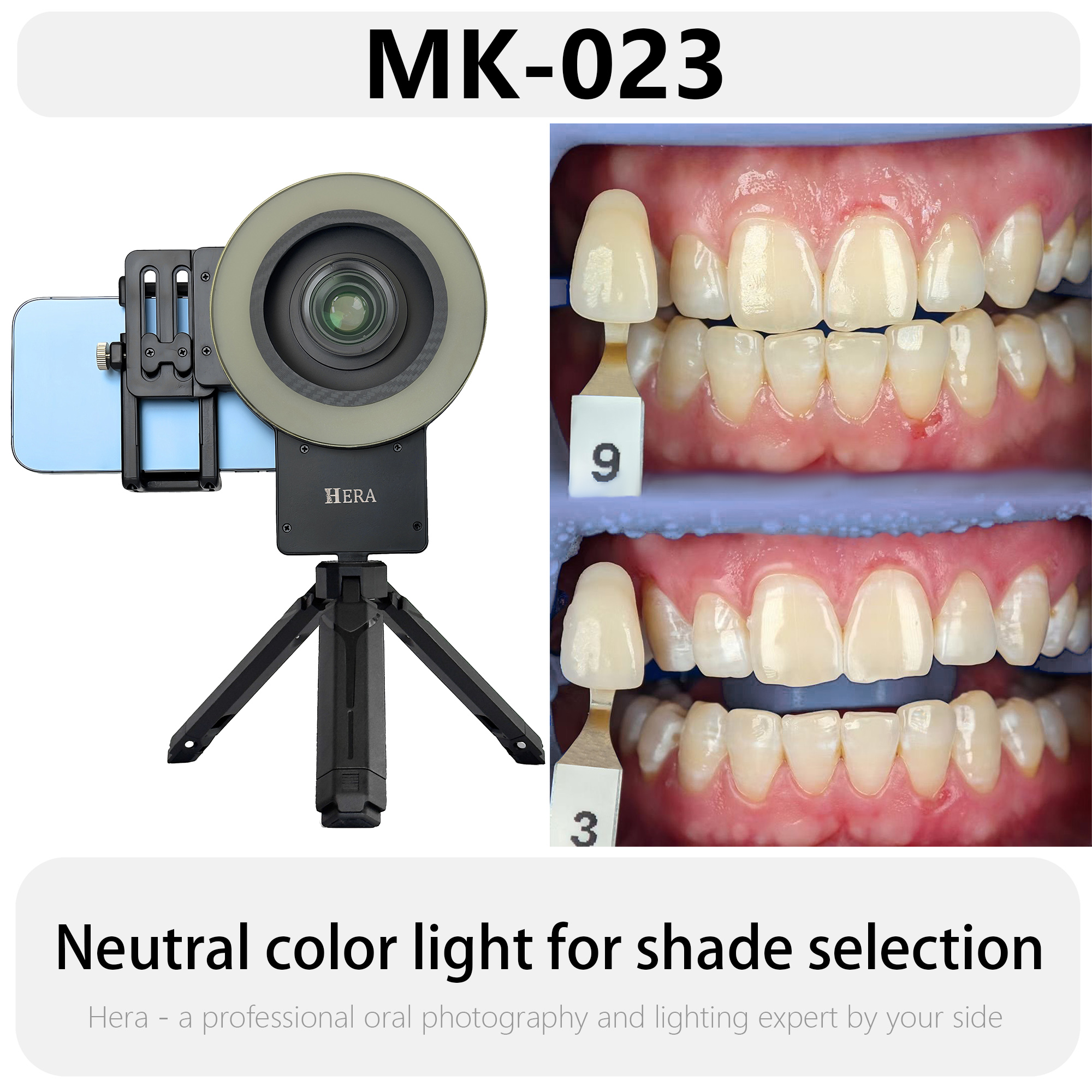 HERA MK-23 Intraoral Dental Ph - огляд і ціна Photography Dental