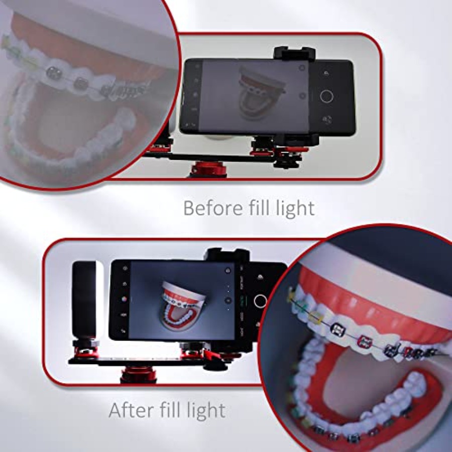 Bluetooth Dental Flash Light P - огляд і ціна Photography Dental