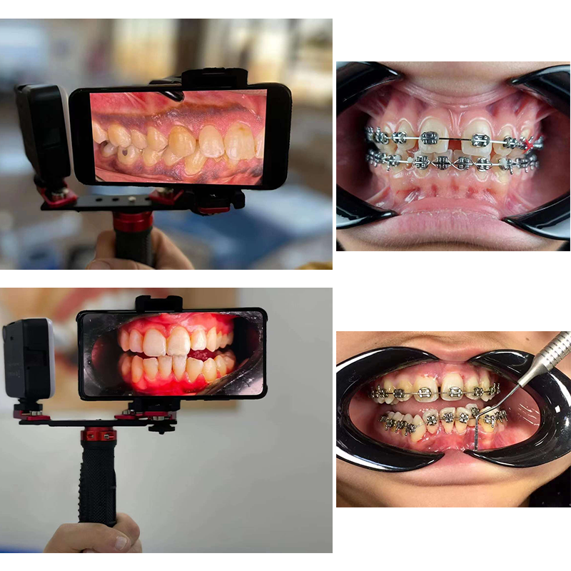 Dentistry Material Mobile Phon - огляд і ціна Photography Dental