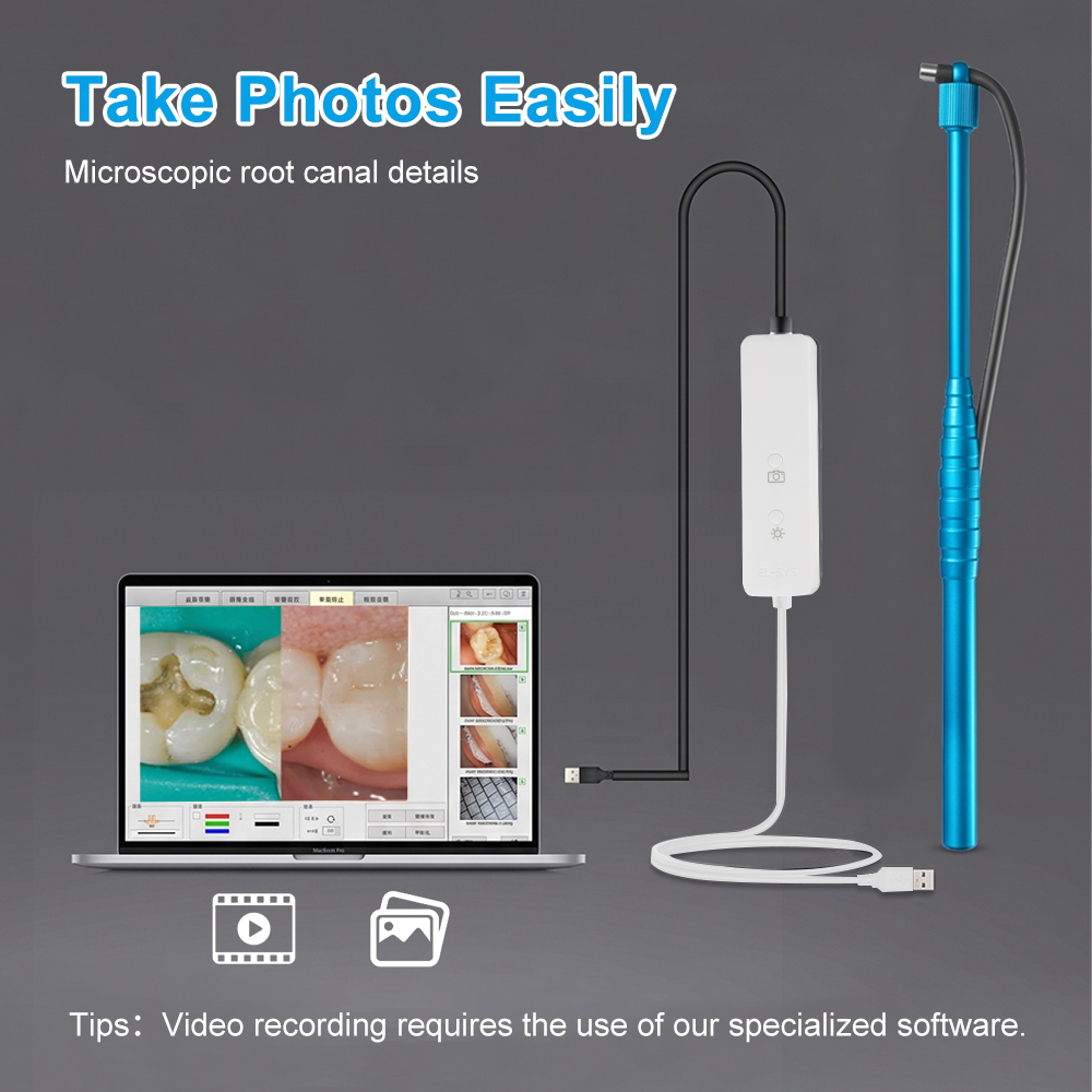 5MP Micro Intraoral Camera Den - огляд і ціна Photography Dental