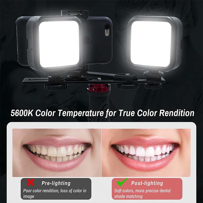Dental Photography Light With  - огляд і ціна Photography Dental
